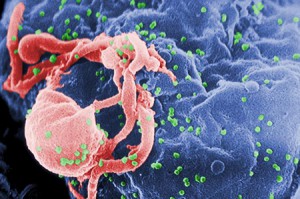 A scanning electron micrograph of HIV-1 virions budding from a cultured lymphocyte. UTEP has been awarded nearly $1.5 million to expand access to substance abuse treatment capacity to minority women at risk for HIV in low-income communities in El Paso County. Photo by C. Goldsmith, Courtesy of Centers for Disease Control and Prevention